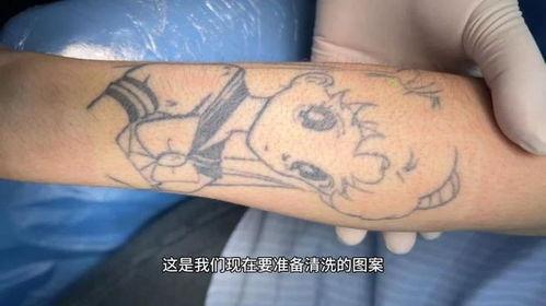 洗纹身前后照片,洗纹身前后对比，见证美丽重生